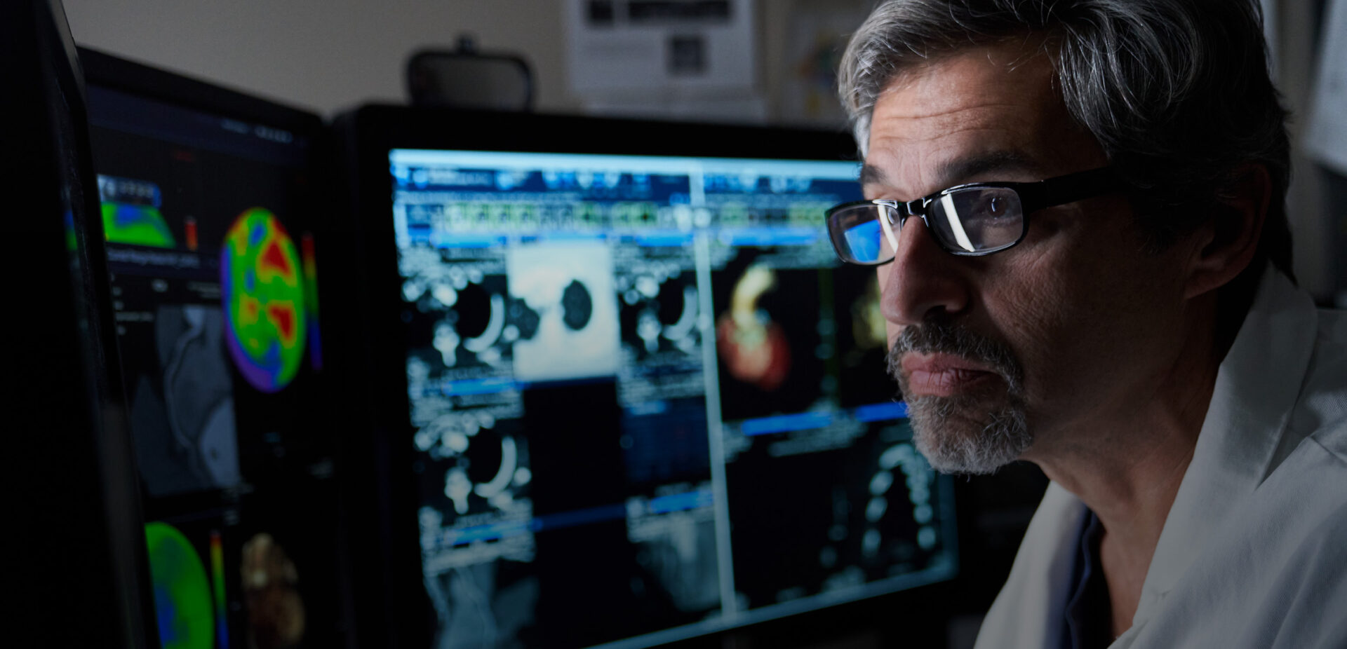 doctor looking at images of a brain on computers