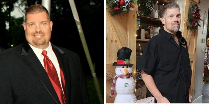 Chris Creech Before and After Weight Loss Surgery Photos