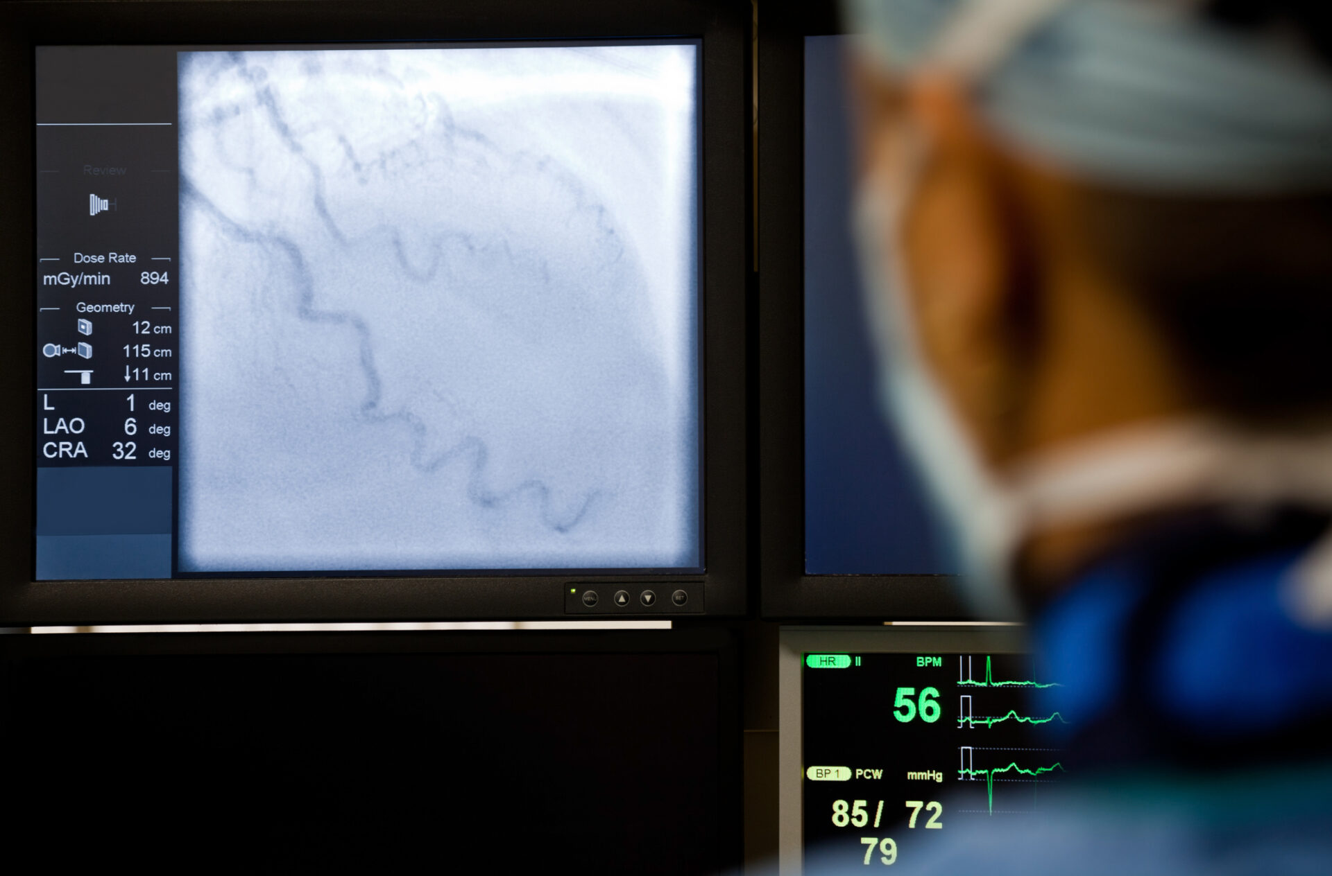 Doctor with mask observing angiography procedure on the monitor.